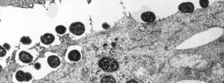 Neisseria meningitidis en cours d'adhésion et d'invasion des cellules épithéliales. © Institut Pasteur
