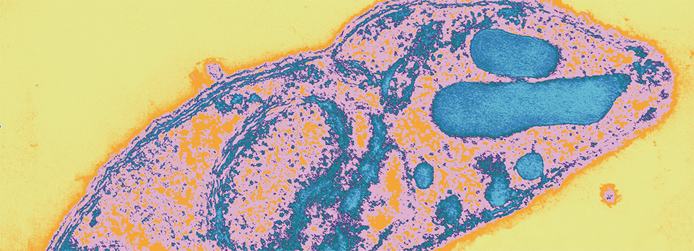 Paludisme - Découverte chez le parasite d'un marqueur moléculaire associé à la résistance au traitement à la piperaquine