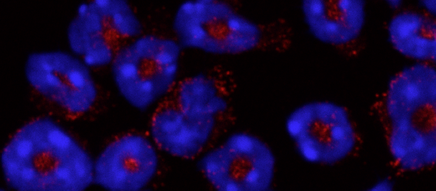 Neutrophiles dont le noyau multilobé est coloré en bleu. En rouge, la myéloperoxidase (MPO), contenue dans des granules cytoplasmiques