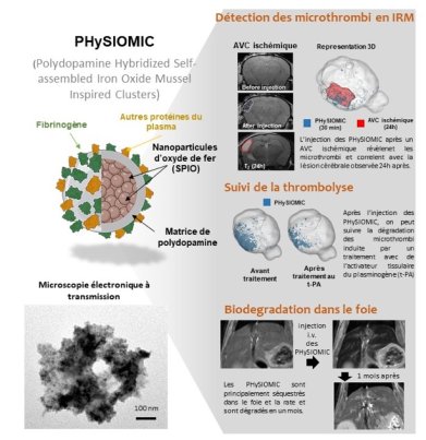 Les travaux de thèse du Dr Jacqmarcq ont permis la mise au point l’agent de contraste, PHysIOMIC (Polydopamine Hybridised Iron Oxide Mussel Inspired Clusters). Les chercheurs ont développé des microparticules magnétiques destinées à être injectées dans la circulation sanguine qui sont capables de se fixer aux microthrombi. Les propriétés magnétiques des microparticules confèrent un signal en IRM et permettent ainsi leur diagnostic (Figure 1). 